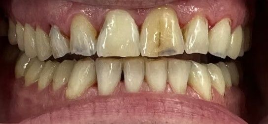 smile ページ smileページ SmileZ Today® Box | ZimVie Americas